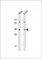 OR5AK2 Antibody (C-term)